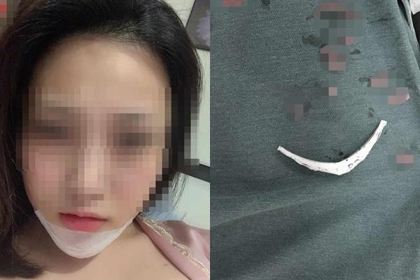 Gái xinh xuất hiện với chiếc cằm dài ngoằng, dân tình đoán già đoán non chắc do dao kéo quá đà đây mà-3