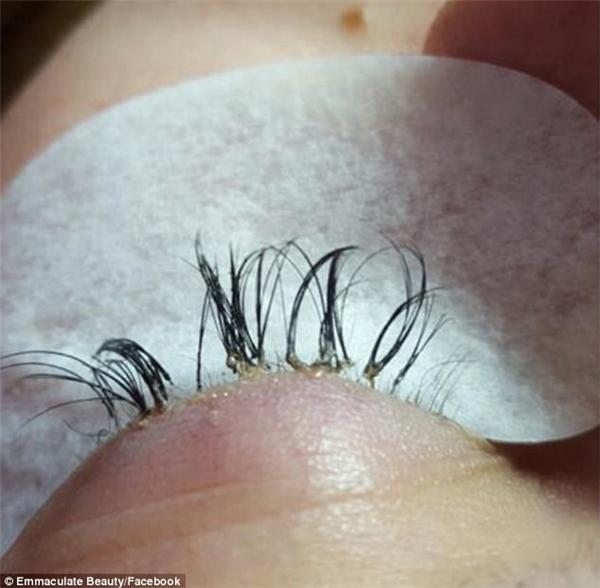 Lại thêm một ca thảm họa nối mi nhìn là thấy nổi da gà-6