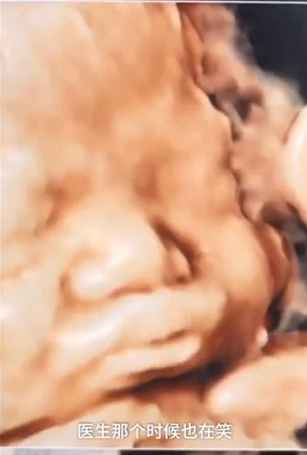 Mạng xã hội xôn xao trước màn dậy thì của em bé sơ sinh sau 3 tháng chào đời-1