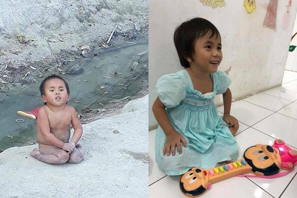 Gần 2 năm được nhận nuôi, điều kỳ diệu đến với em bé từng bị bỏ rơi giữa mùa đông lạnh giá ở Mường Lát-1