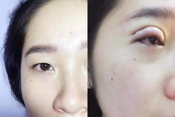 Vợ TGĐ Phan Thành đang bỉm sữa vẫn đi nhấn mí-11