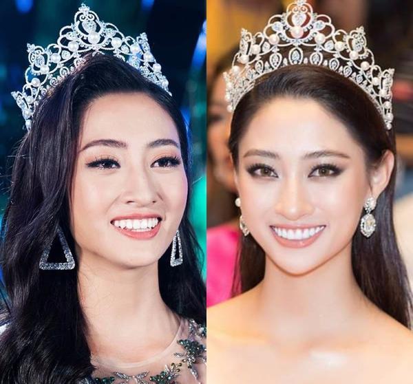Rộ tin đồn hoa hậu Lương Thùy Linh làm lại răng sau 1 tháng đăng quang Miss World Vietnam-1
