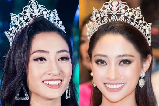 Rộ tin đồn hoa hậu Lương Thùy Linh làm lại răng sau 1 tháng đăng quang Miss World Vietnam
