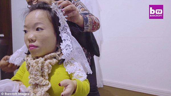 Kết hôn sau 8 năm yêu, cặp đôi vợ chồng 90cm khó sinh con bây giờ ra sao?-6