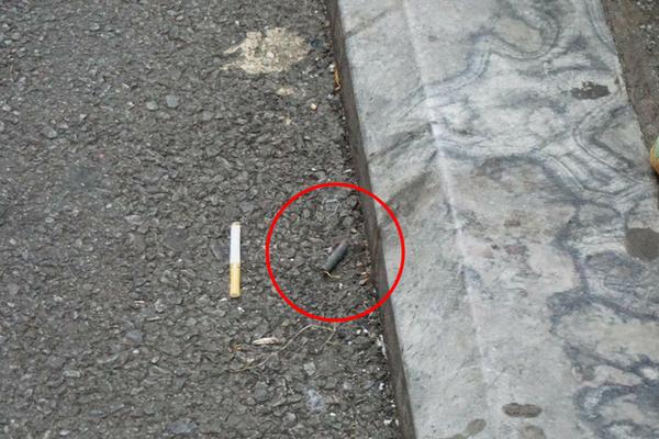 Phẫn nộ: Cháu bé đang ngủ say trong nhà bị bác ruột dùng vác dao sang chém đứt lìa 2 tay ở Bắc Giang-2