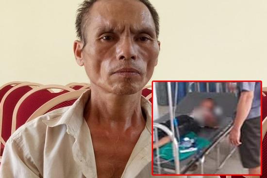 Bé trai bị bác họ chém đứt lìa bàn tay hỏng hoàn toàn một bên mắt trái