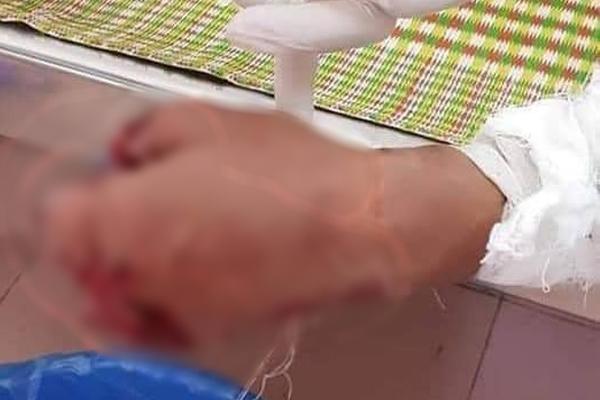 Nổ Iphone khi sạc, thanh niên làm thuê ở Lâm Đồng thiệt mạng-2