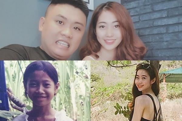 9X thay đổi hoàn toàn sau phẫu thuật thẩm mỹ bỏ hàm hô-5