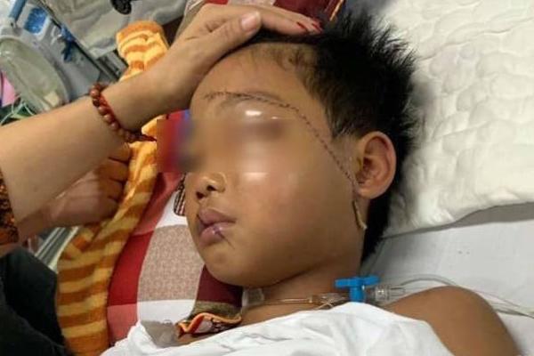 Vụ cháu bé bị bác họ chém đứt lìa tay ở Bắc Giang: Nạn nhân vô cùng sợ hãi, hoảng loạn khi tỉnh lại-1