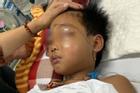 Vụ cháu bé bị bác họ chém đứt lìa tay ở Bắc Giang: Nạn nhân vô cùng sợ hãi, hoảng loạn khi tỉnh lại