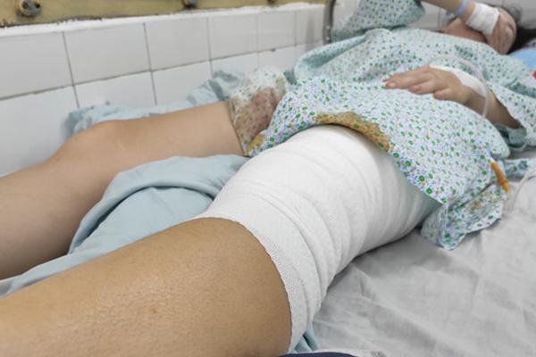 Nữ cổ động viên kể khoảnh khắc bị pháo sáng ném vào chân ở Hàng Đẫy-1