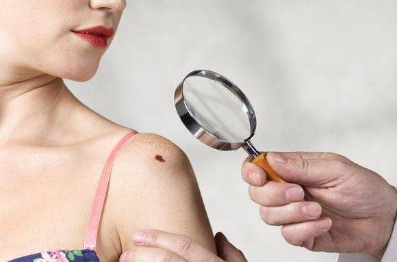 Tiết lộ nốt ruồi là điểm vàng hút tiền của 12 con giáp, hưởng no may mắn, tài lộc suốt đời-2