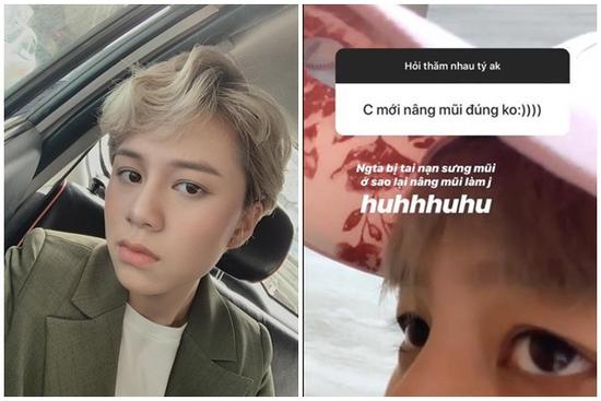 Bị nghi nâng mũi, Bảo Hân 'Về nhà đi con' lên tiếng