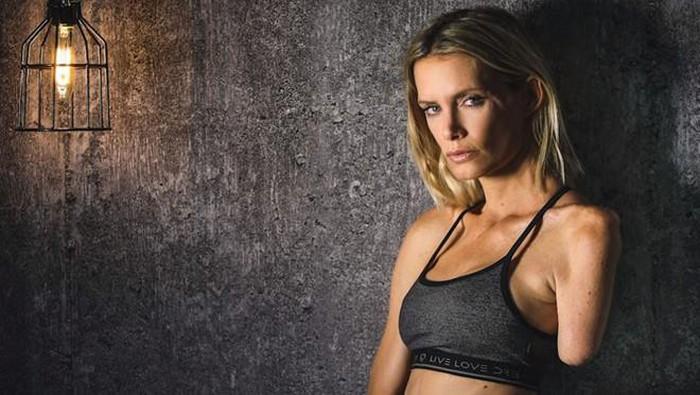 Đoàn phim bỏ rơi diễn viên ngã chảy máu não, cắt bỏ tay khi đang quay-1