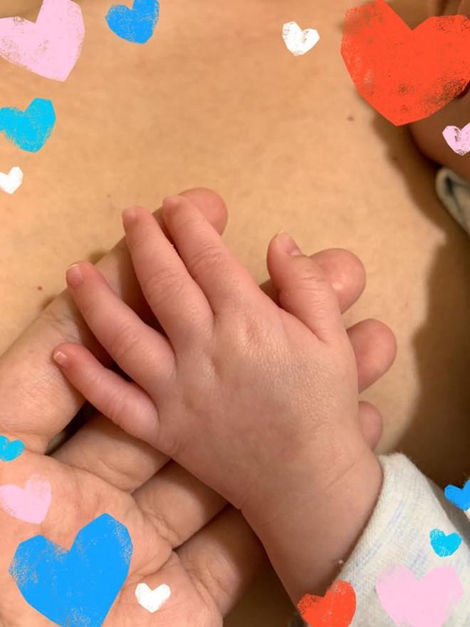 Loạt ca sĩ tên Ngọc bị vận xui đeo bám: Người bỏng nặng đau đớn, người thoát bệnh hiểm nghèo-10