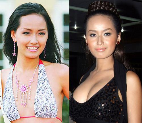 Dàn hoa hậu đối diện tin đồn nâng ngực - người thừa nhận, kẻ úp mở-7