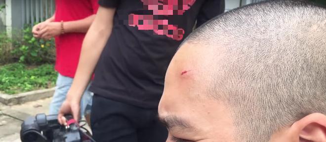 Trương Ngọc Ánh, Lý Hải và những nghệ sĩ gặp tai nạn trên phim trường-6