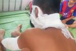 Chùm bóng bay phát nổ, 3 cầu thủ U14 Sông Lam Nghệ An nhập viện