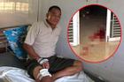 Vụ em trai nổ súng bắn vợ chồng anh ruột ở Bình Phước: 'Nó nổ súng ầm ầm, bắn điên cuồng'