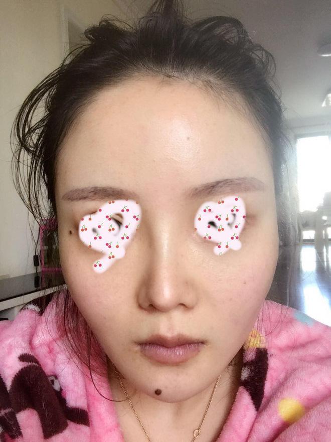 Trai xinh gái đẹp khiến ai nấy hết hồn khi khoe cận gương mặt giống nhau như tạc sau thẩm mỹ-4