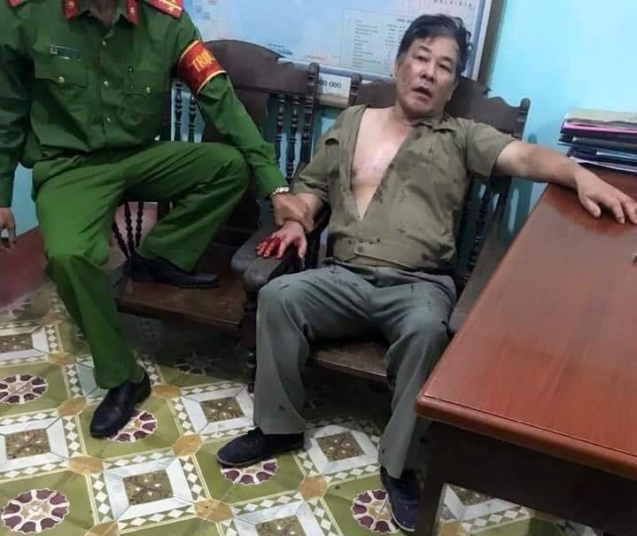 Vụ anh trai truy sát cả nhà em gái: Đau lòng lời kể người nhà nghi phạm về số tiền 3,6 tỷ đồng-2