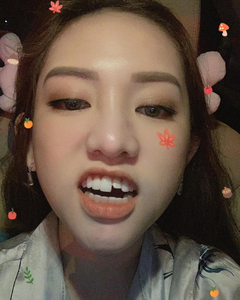 Quế Vân rụng răng sứ trông dở khóc dở cười-9