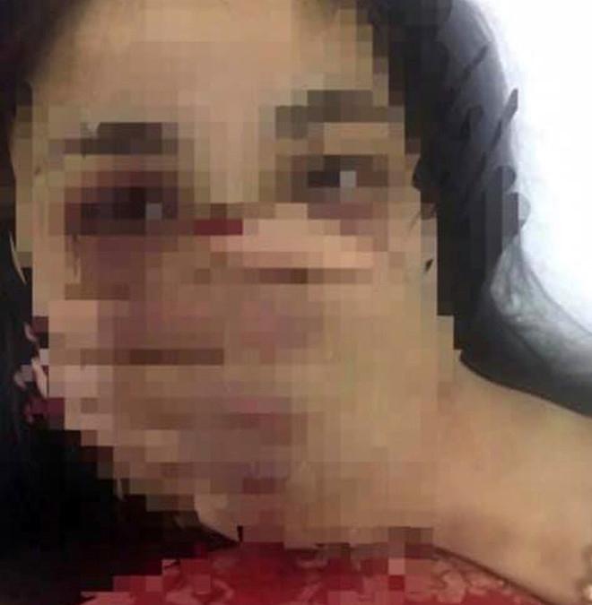 Bác sĩ xin nghỉ việc sau nghi vấn hành hung nữ sinh thực tập-1