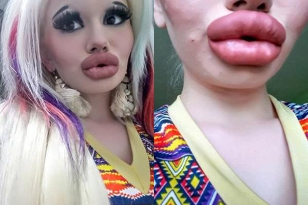 Thả nhẹ tấm ảnh lúc chưa dao kéo, hotgirl môi xúc xích làm mọi người tiếc nuối nhan sắc một thời-1