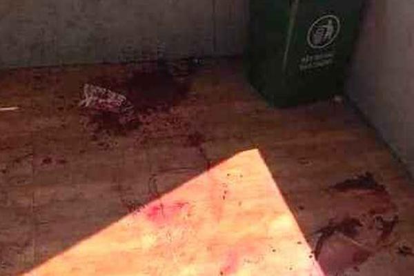 Người đàn ông sức khỏe nguy kịch dẫn đến tử vong sau 3 ngày vào nhà nghỉ với bạn gái-2