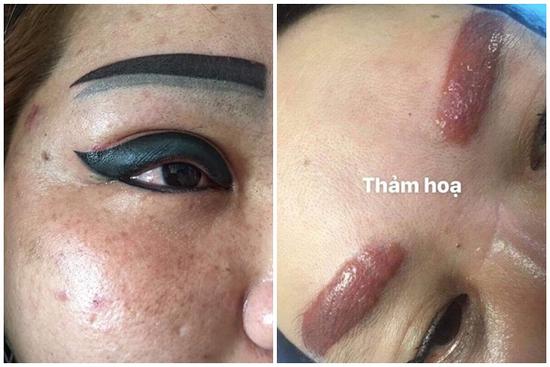 KINH HÃI THẢM HỌA THẨM MỸ: Xăm lông mi mà như có con đỉa bám vào mắt