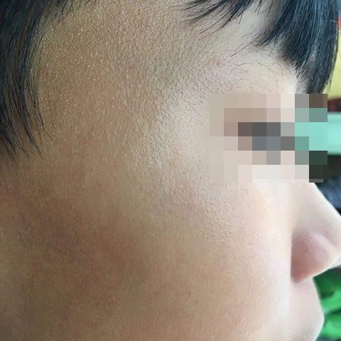 TP.HCM: Tài xế xe ôm công nghệ nghi hành hung học sinh lớp 9 dẫn đến chấn thương vì đứng sai điểm đón-2