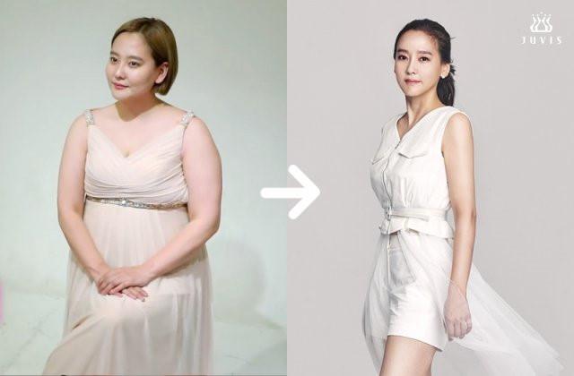 Sao Hàn thay đổi khó nhận ra sau khi giảm cân-5