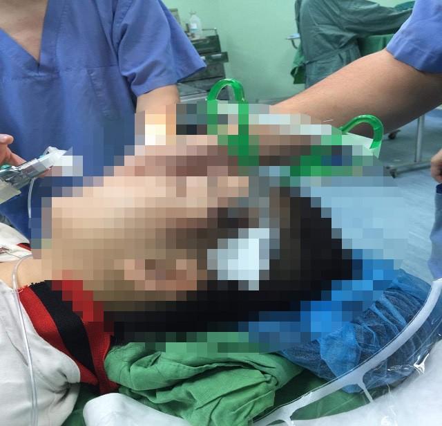 Nô đùa cùng bạn trong lớp, bé gái 10 tuổi bị kéo đâm sâu vào đầu-1
