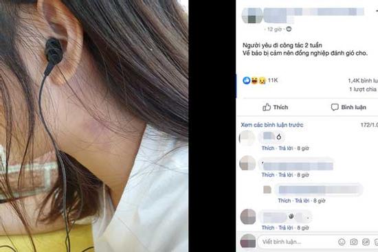 Bạn gái kể được đồng nghiệp đánh gió, dân mạng khuyên chàng trai nên xem lại 'sừng' trên đầu mình