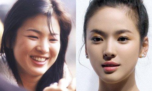Lại xuất hiện trẻ xinh như gái 20, Song Hye Kyo sau ly hôn như ngày một nhuận sắc-5
