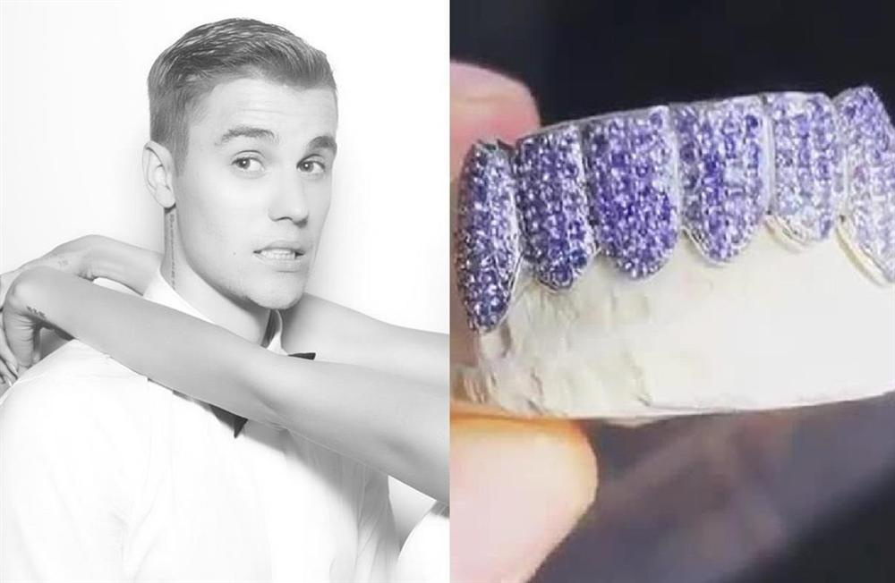Ngoài bộ trang sức cưới sương sương 17 tỷ đồng, Justin Bieber sắm bọc răng kim cương 600 triệu đồng-3