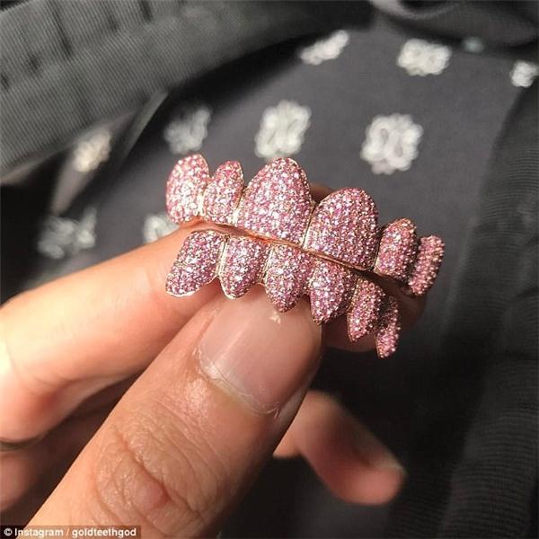 Ngoài bộ trang sức cưới sương sương 17 tỷ đồng, Justin Bieber sắm bọc răng kim cương 600 triệu đồng-5