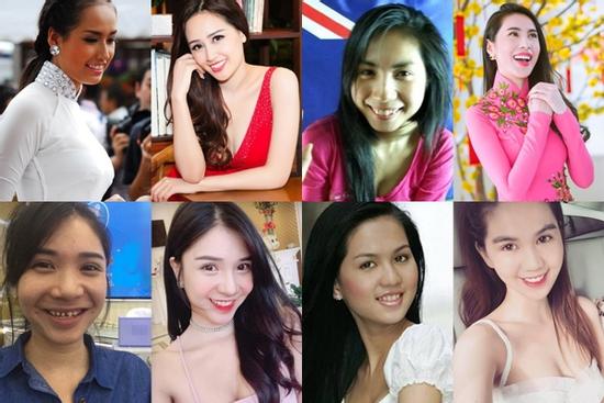 Bọc răng sứ giúp Mai Phương Thúy, Ngọc Trinh lên đời nhan sắc, nhưng chưa bằng 2 mỹ nhân này!