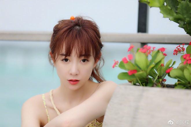 Thảm họa thẩm mỹ Trương Mông lấy lại nhan sắc-1