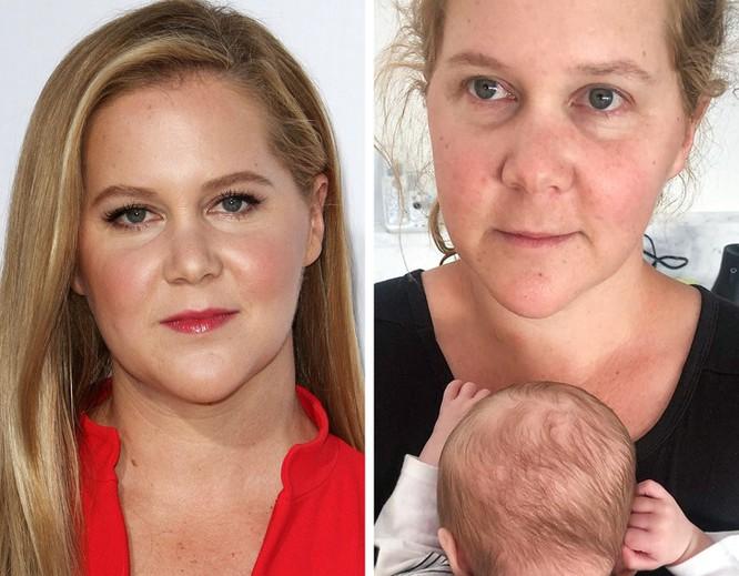 Diễn viên Amy Schumer