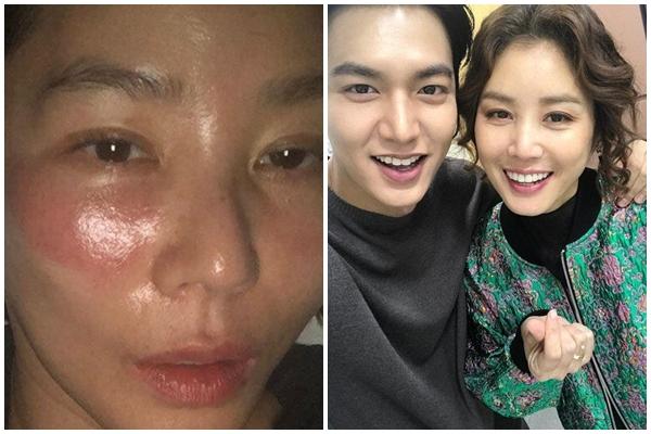 Cô gái mất một tiếng chỉ để lột miếng mặt nạ dính chặt vào da-4