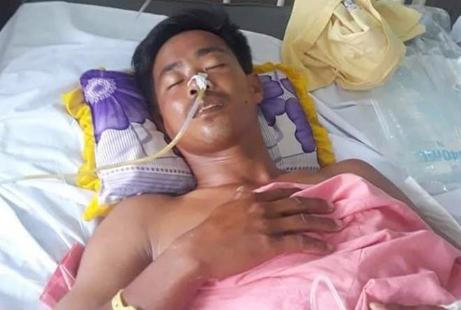 8X dùng xung điện bắt cá bị bắn thủng bụng-1