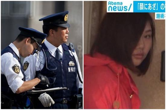 Nhật bắt nữ sinh Việt hành nghề thẩm mỹ trái phép