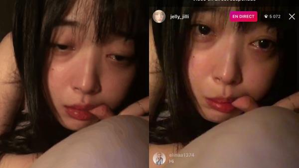 Căn bệnh đã lấy đi sinh mạng của công chúa Sulli thực ra nguy hiểm đến mức nào?-2