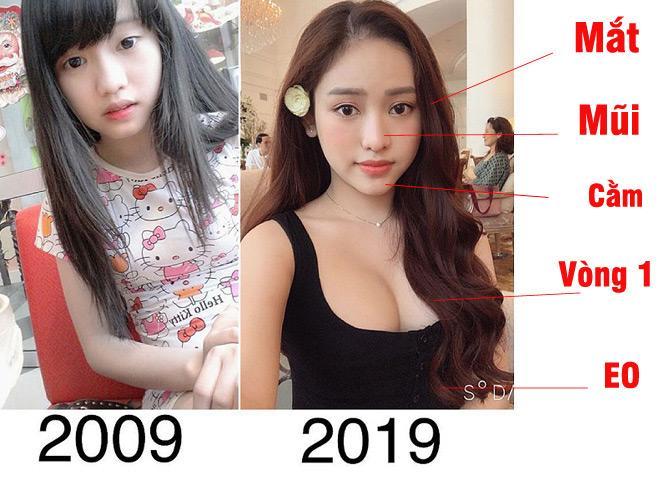 Thúy Vi bất ngờ rút túi nâng ngực, antifan cà khịa: Rồi có tháo luôn mấy chỗ sửa trên mặt không?-1