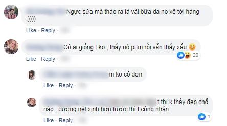 Thúy Vi bất ngờ rút túi nâng ngực, antifan cà khịa: Rồi có tháo luôn mấy chỗ sửa trên mặt không?-8