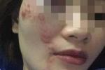 Khởi tố, truy bắt nhóm thanh niên đánh nữ nhân viên xe buýt ở Hà Nội-3
