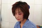 Khởi tố, truy bắt nhóm thanh niên đánh nữ nhân viên xe buýt ở Hà Nội
