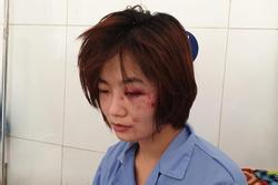 Khởi tố, truy bắt nhóm thanh niên đánh nữ nhân viên xe buýt ở Hà Nội