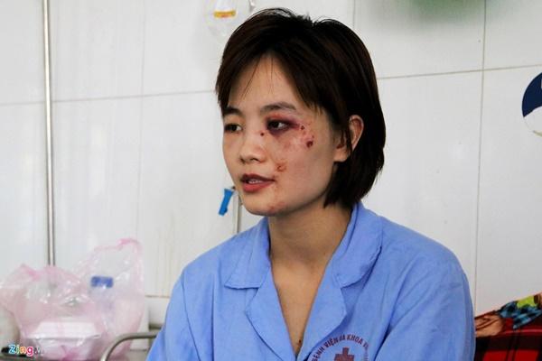 Nữ phụ xe bị 5 thanh niên đánh nhập viện: ‘Tôi tủi thân và ám ảnh’-1